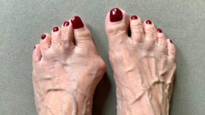 Paras vaivaisenluun oikaisija